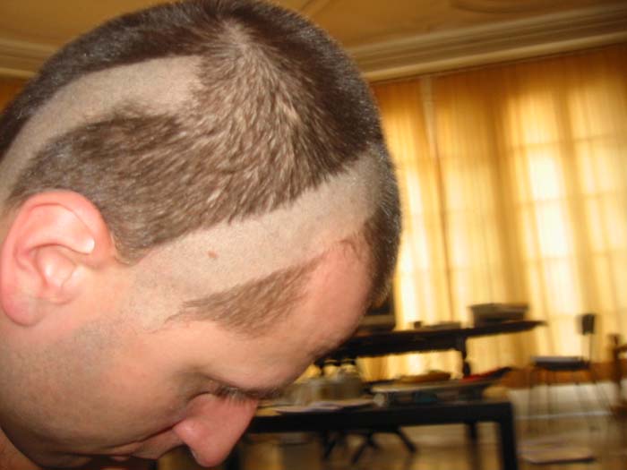 Tonsure