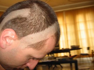Tonsure